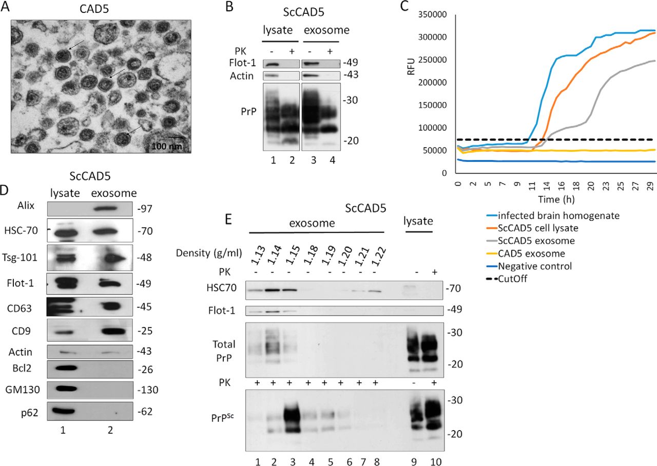 exosomes